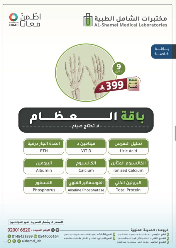 باقة العظام